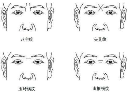 面相額頭紋